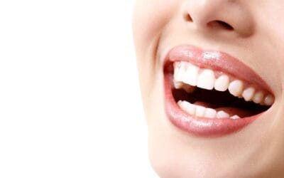 Teeth Whitening in Petrolia: Professional vs. At-Home Options