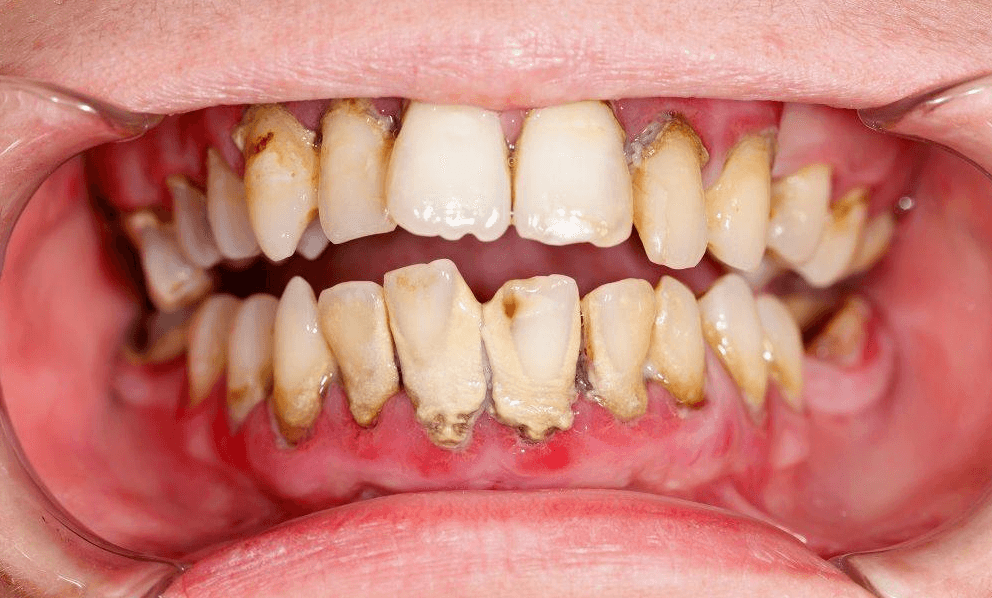 dentist in Petrolia